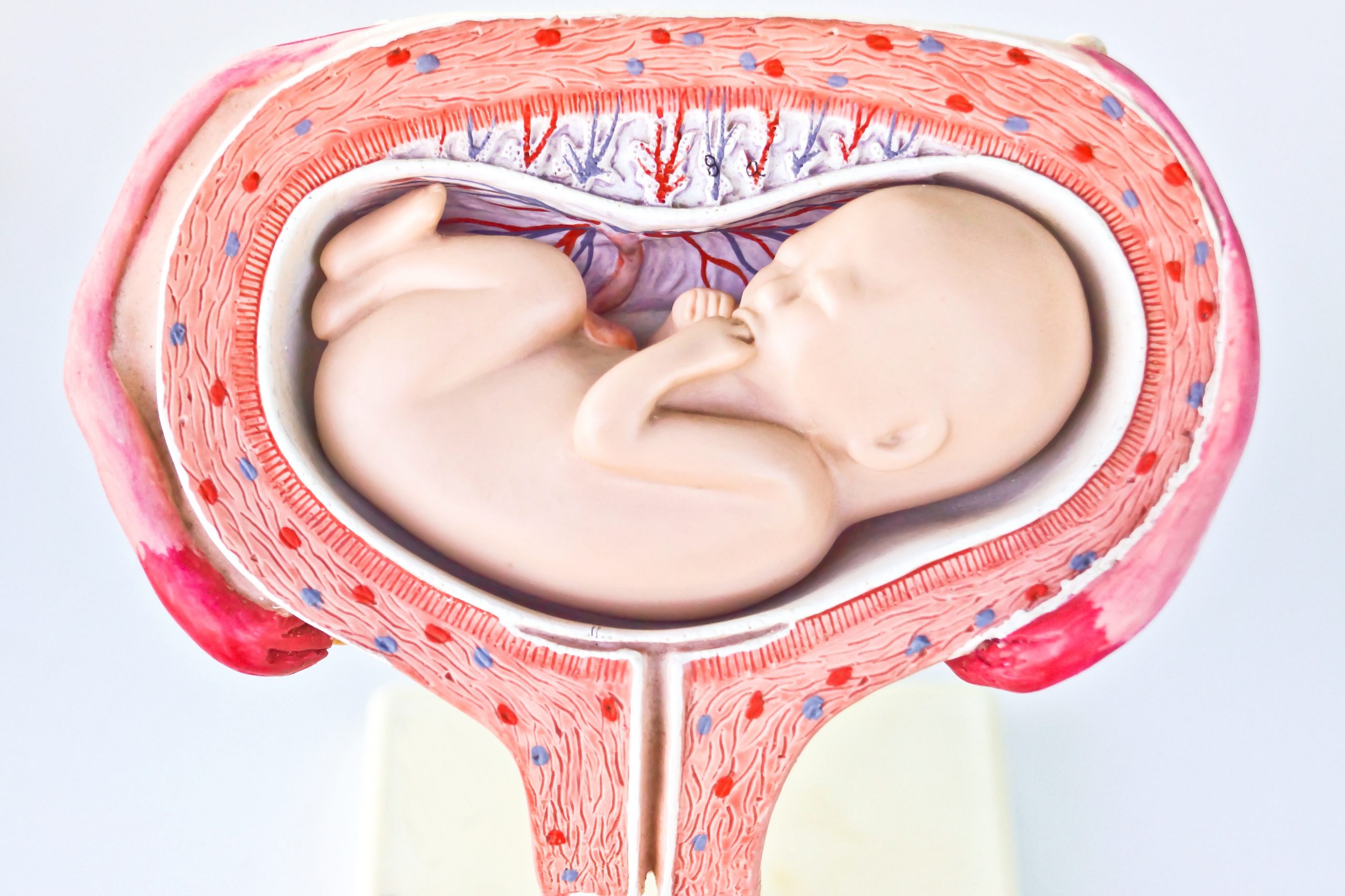 Плод 41 неделя. Пуповина и плацента фото. Расположение ребенка в матке.